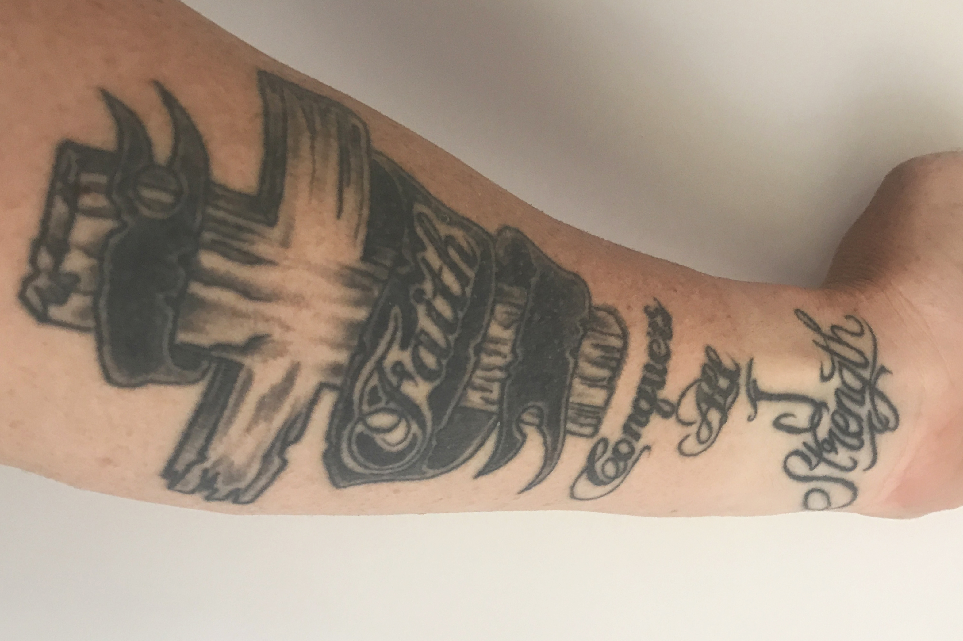 Tattoos and skin cancer