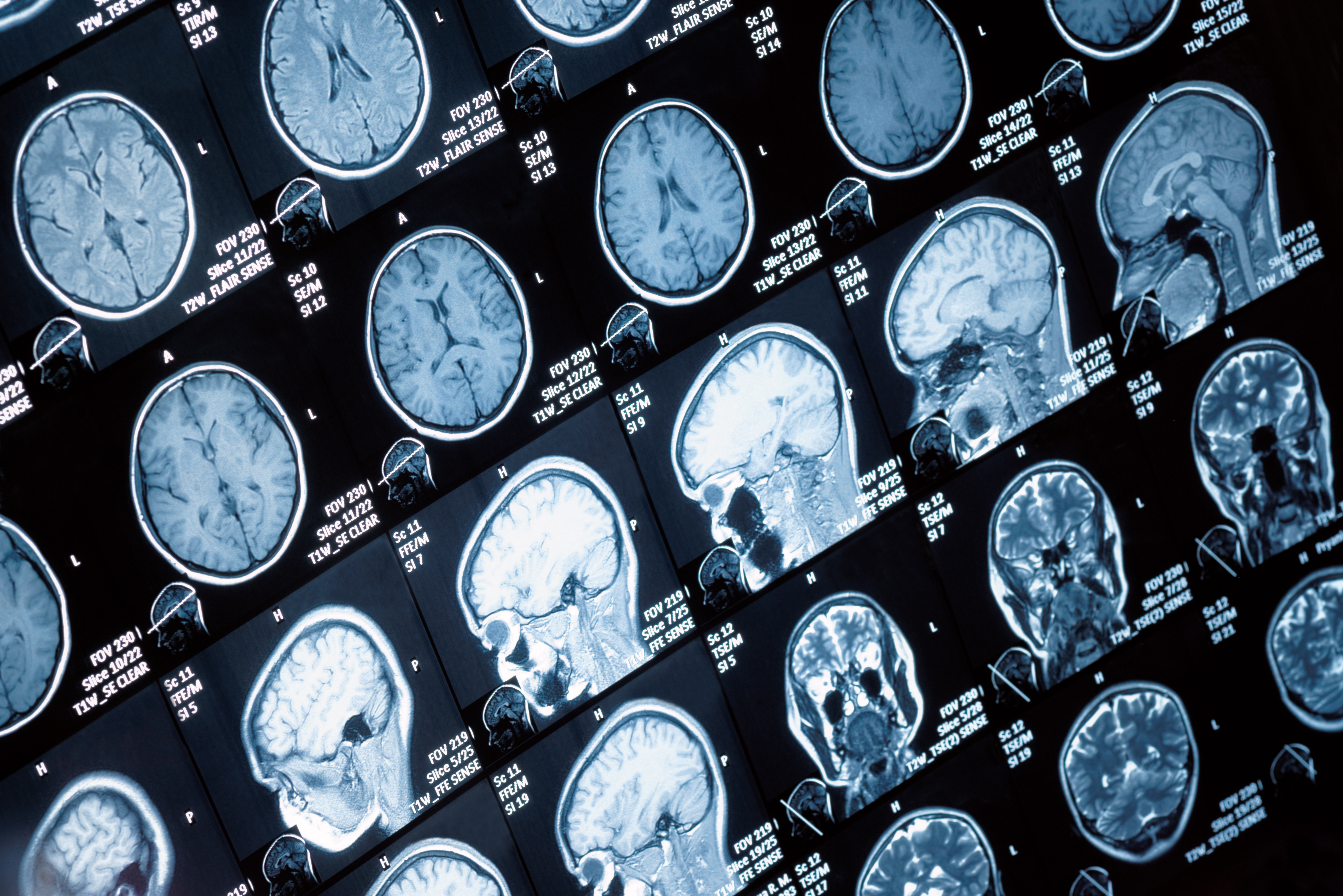The Unwelcome Guest: Waiting, knowing and MRIs