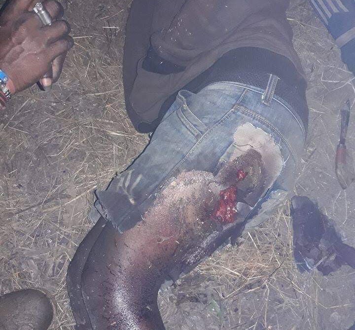 Exclusive: Chemical weapons dropped on Papua