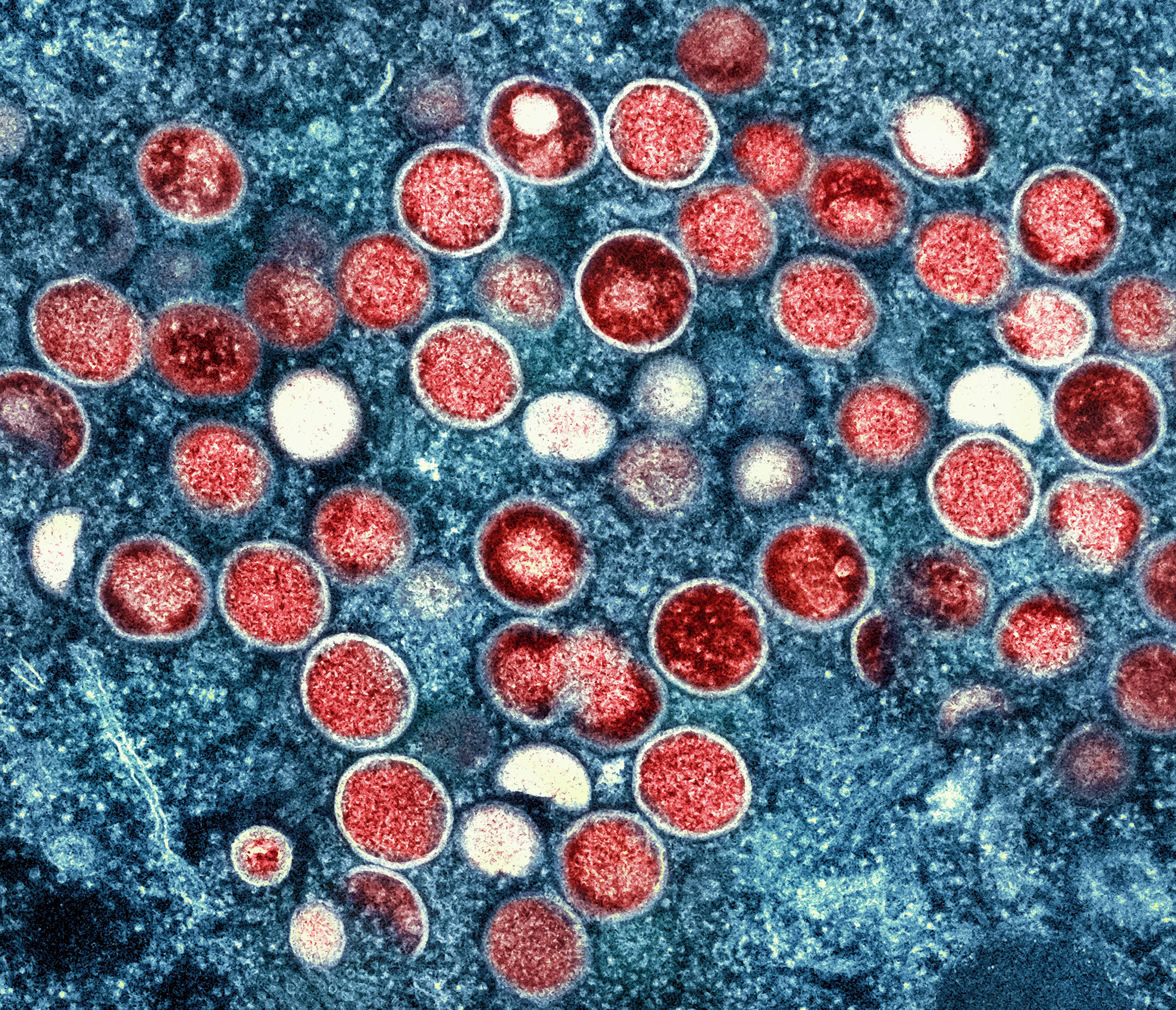 Lessons for Australia’s monkeypox response