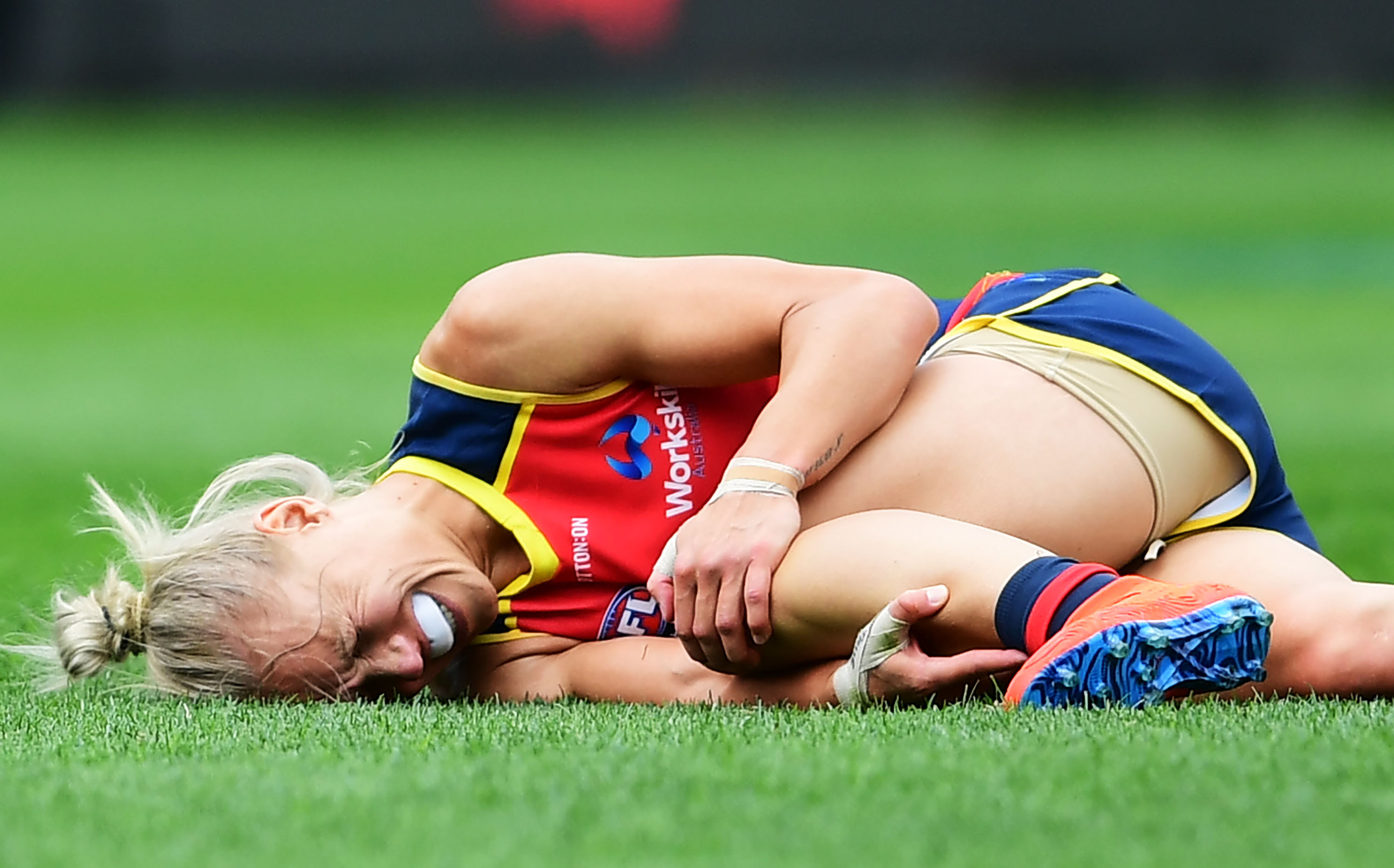 Working to reduce ACL injury rates